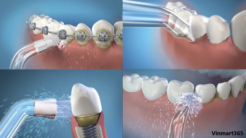 Làm sạch thức ăn thừa và mảng bám hiệu quả