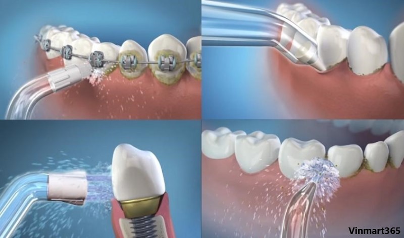 Máy tăm nước H2ofloss cao cấp